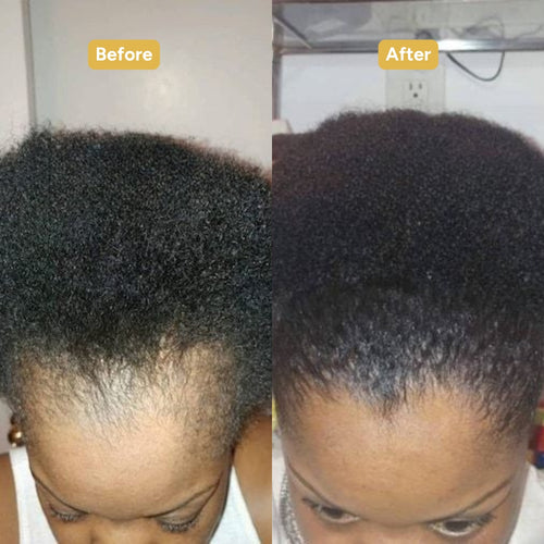 (Save 50%) Reavae Hair Complex