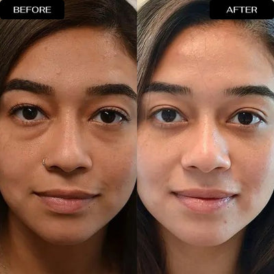 4D Eye Renewal Complex