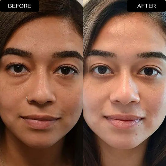 4D Eye Renewal Complex