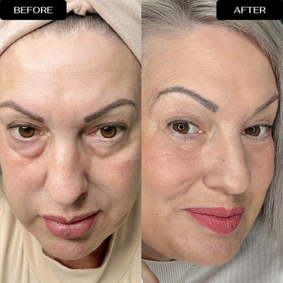 4D Eye Renewal Complex