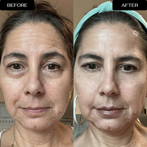 4D Eye Renewal Complex