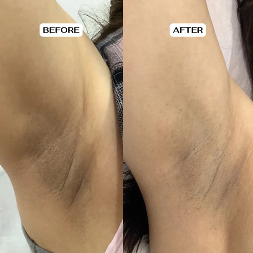 Glycolic Acid Body Stick