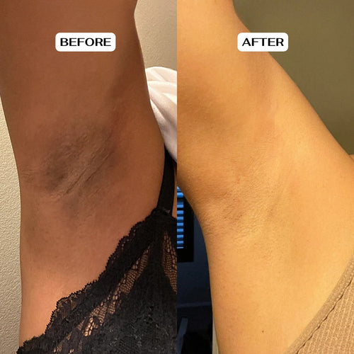 Glycolic Acid Body Stick