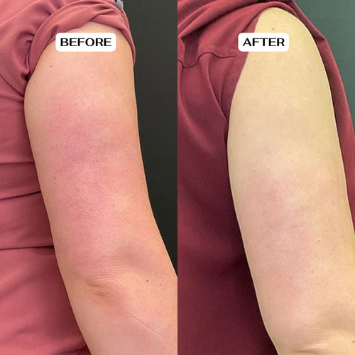 Glycolic Acid Body Stick