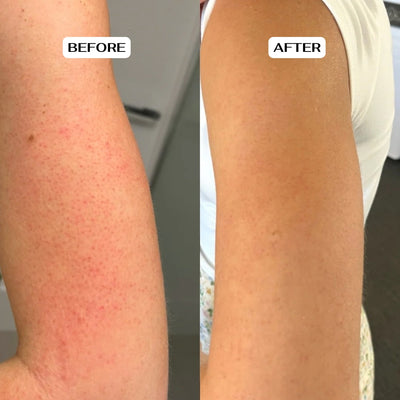 Glycolic Acid Body Stick